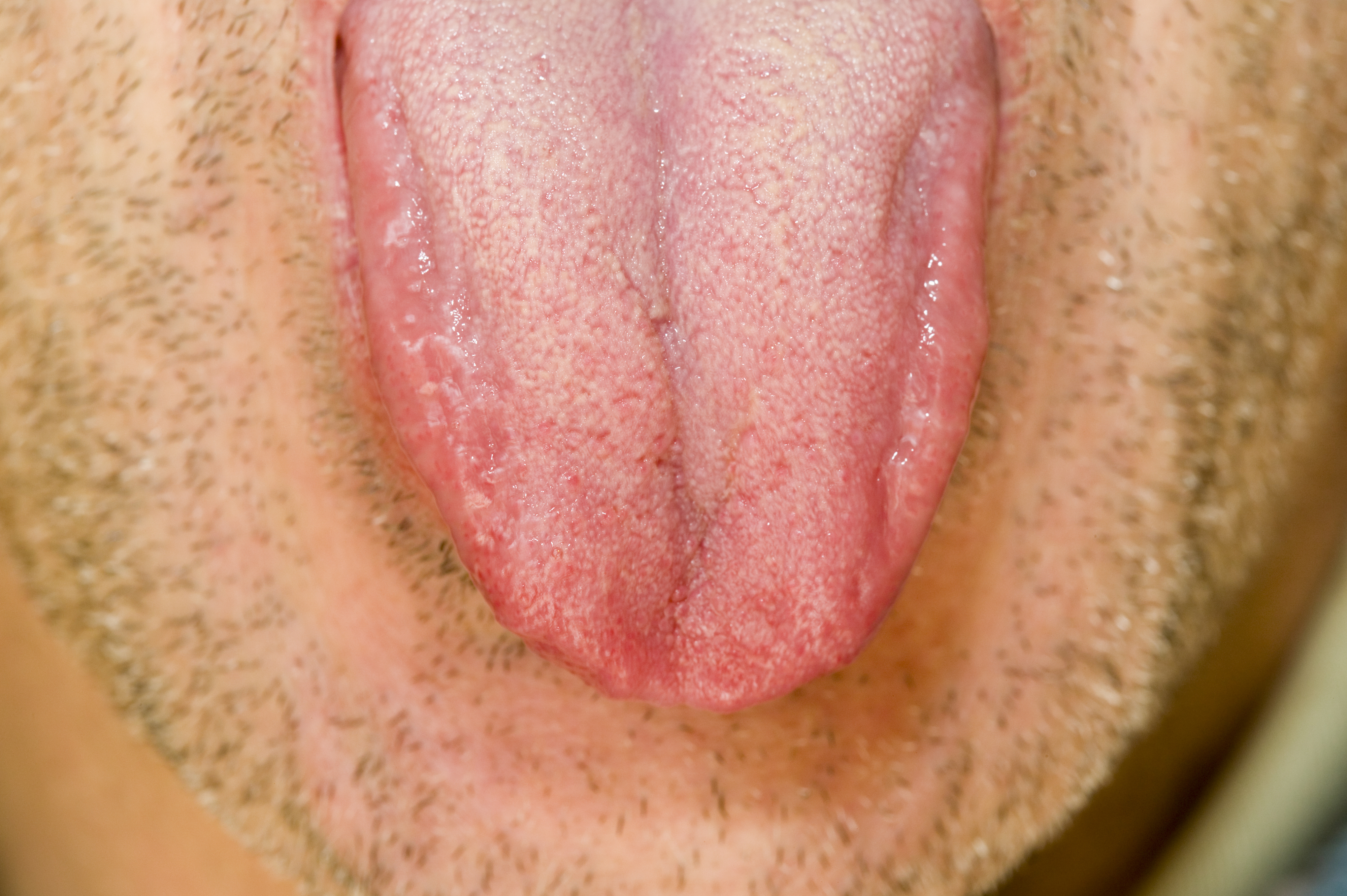 Close-up of a person's tongue sticking out, surrounded by facial stubble
