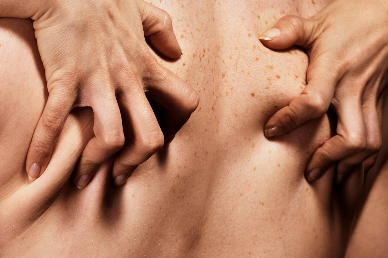 Close-up of hands gently clutching a freckled back, conveying intimacy
