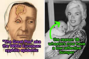 Left: Illustration of a person with a 1490s syphilis infection. Right: Black and white photo of a woman holding a baby with humorous text overlay