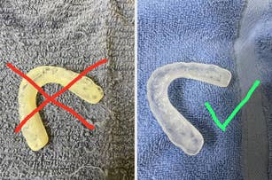 Two dental retainers: yellow one marked with an X on the left, clear one with a checkmark on the right, placed on towels