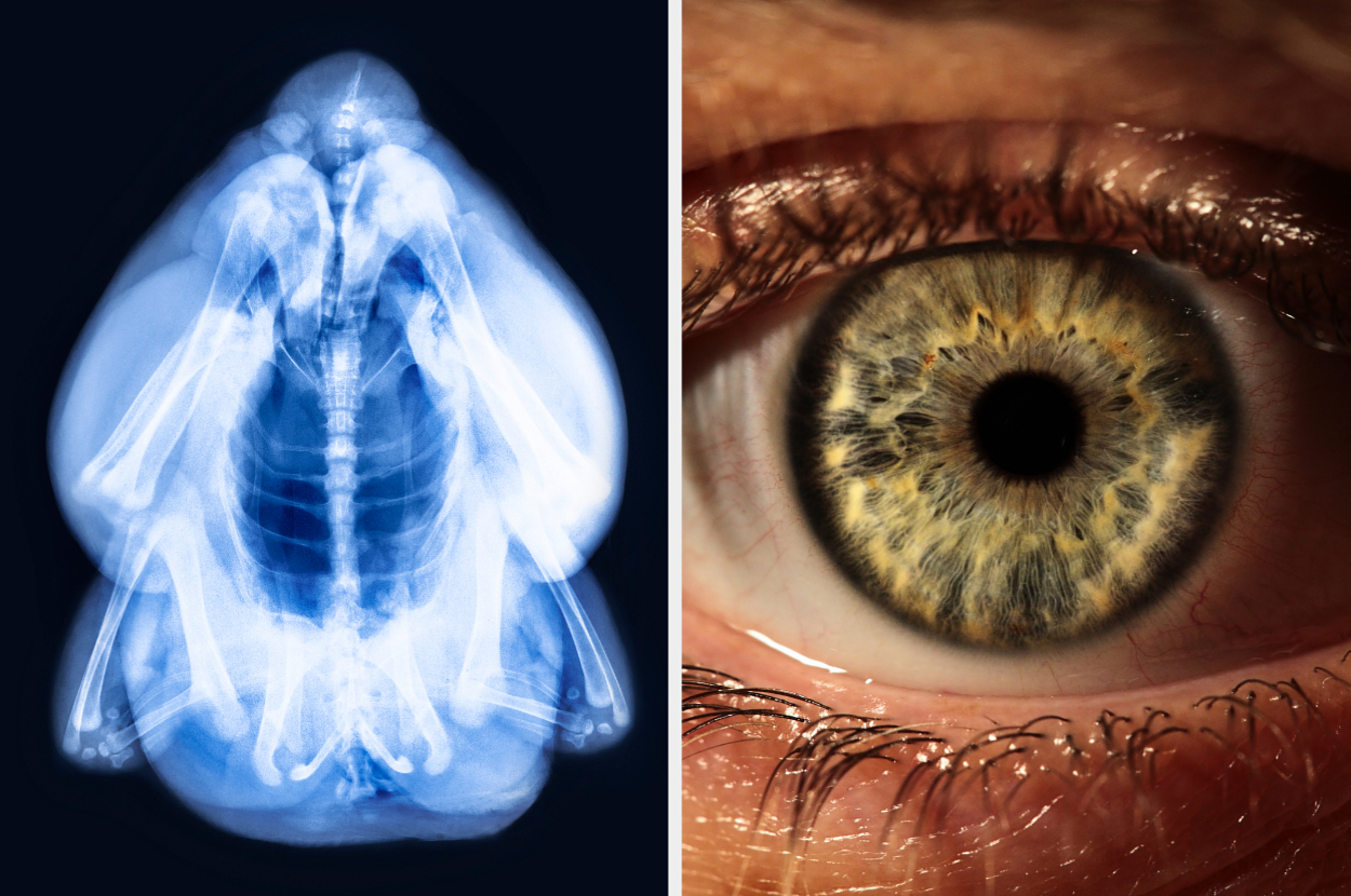 if you can figure out these x ray images your eye 2 5875 1734478150 0 dblbig