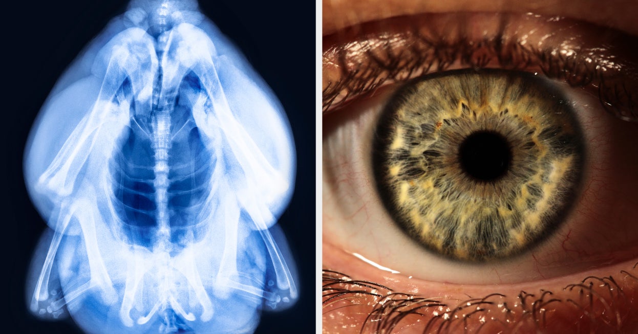 If You Can Determine Out Those X-Ray Pictures, Your Eyes Are Subsequent-Stage
