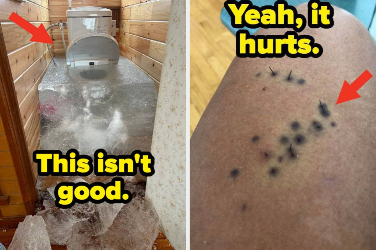 Left image shows a frozen toilet with caption, "This isn't good." Right image shows a leg with splinters and caption, "Yeah, it hurts."
