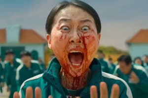 Person in green tracksuit with a shocked expression and fake blood on face at a dramatic scene, possibly from a TV or movie set. People behind are blurred