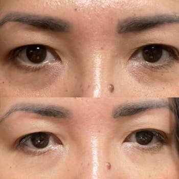 Close-up of a woman's eyes before and after using an eyelid tape product, showing a lifted appearance in the lower image