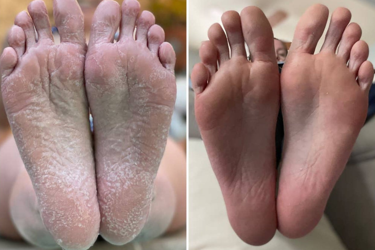 31 Products With Unexpectedly Exciting Before And After Photos 1 original 17310 1735494288 2