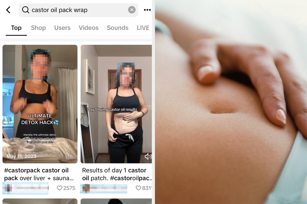 Experts Sound Off On The Castor Oil Pack Trend
