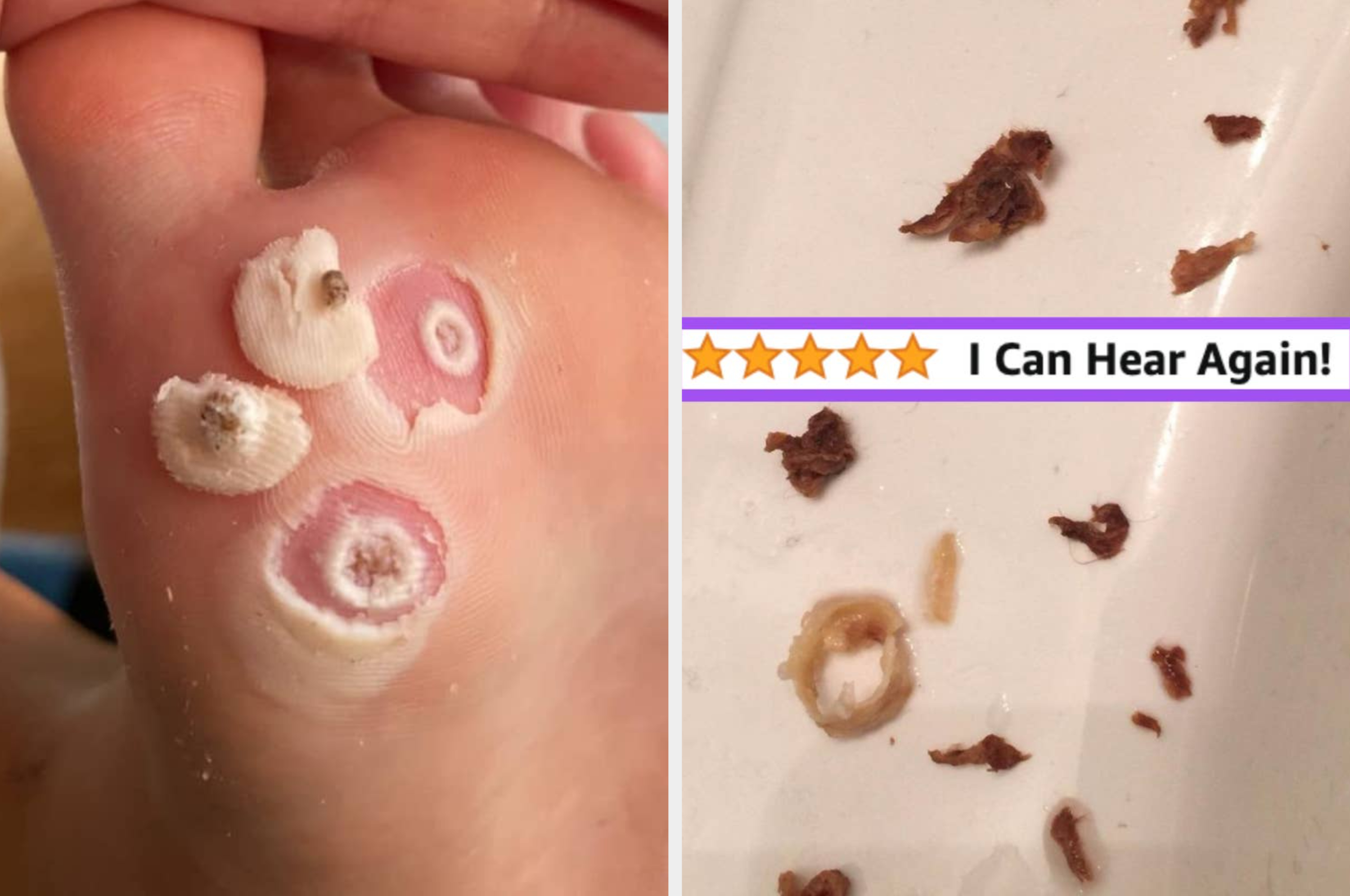 left: a fine tooth comb with dry skin flakes in it. right: nails before and after using an anti-yellowing treatment