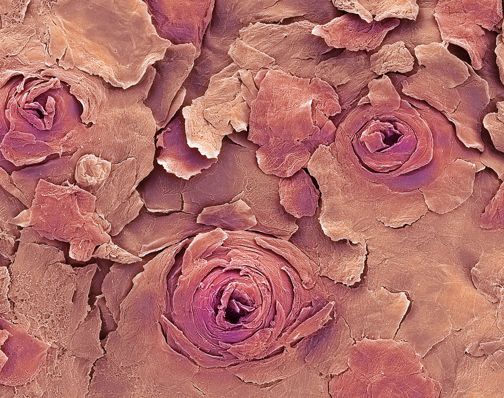 Close-up of human skin under a microscope, showing detailed textures and patterns resembling rose petals