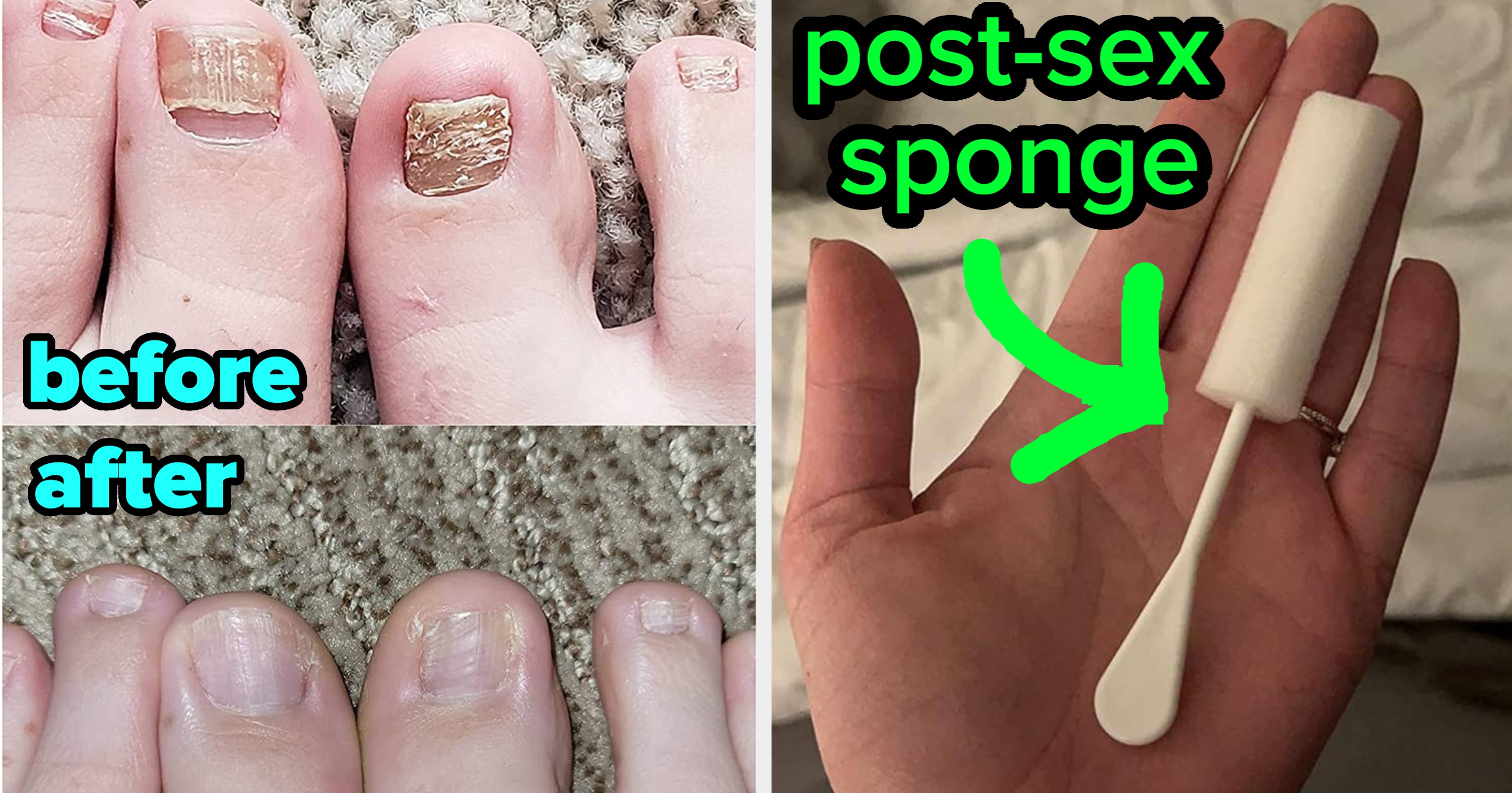 NextImg:34 Things You Can Buy Online For Problems You'd Rather Not Broadcast