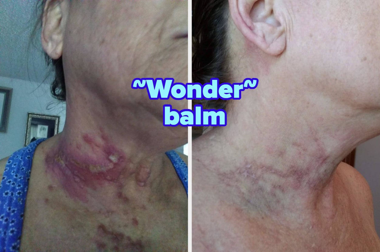 Earwax, Ingrowns, Clogged Pores: 44 Things To Help Resolve The Body Issues You Wish Didn't Exist