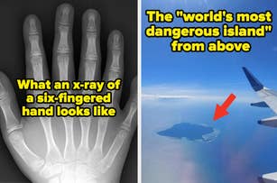 Left: X-ray of a six-fingered hand. Right: Aerial view of an island labeled "world's most dangerous island" with an arrow pointing to it