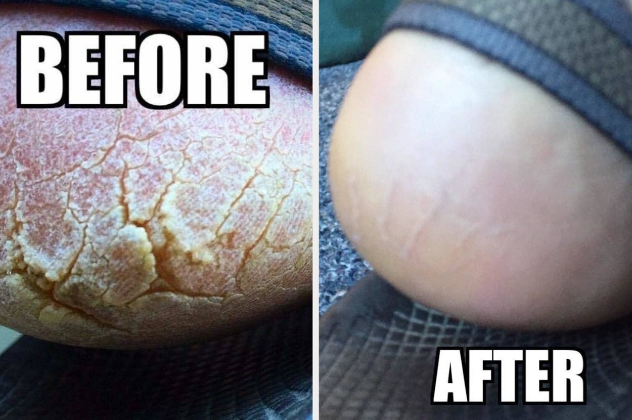 These 33 Products Work Scary Good, And We've Got The Reviewer Pics To Prove It