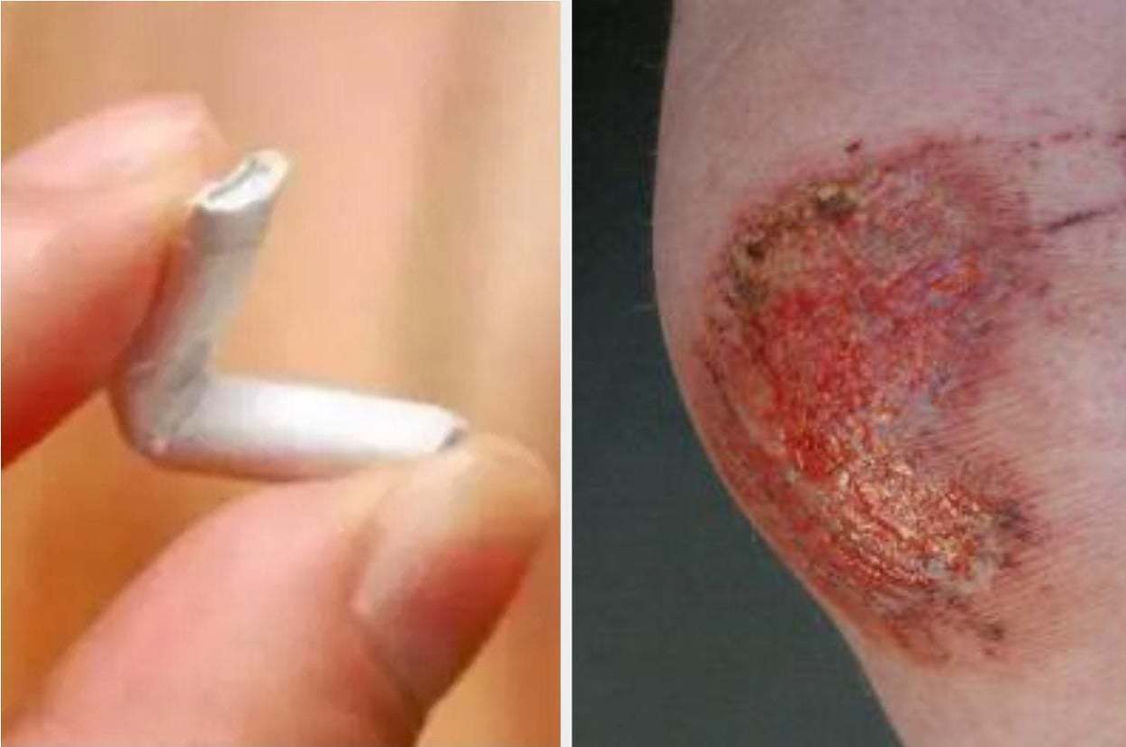 Two-panel image: Left shows a bent cigarette, right shows a close-up of an injured arm with a large wound