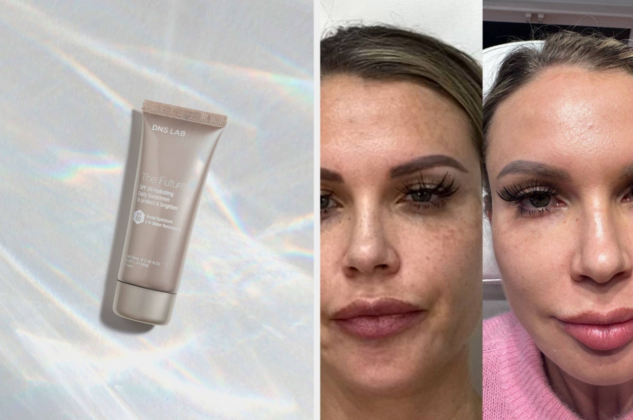Skincare product tube with two before-and-after skincare treatment photos showing visible skin improvement