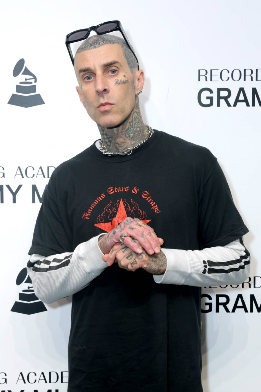 Celebs Who Have Tattoos Or Have Removed Them, image size:900x1350
