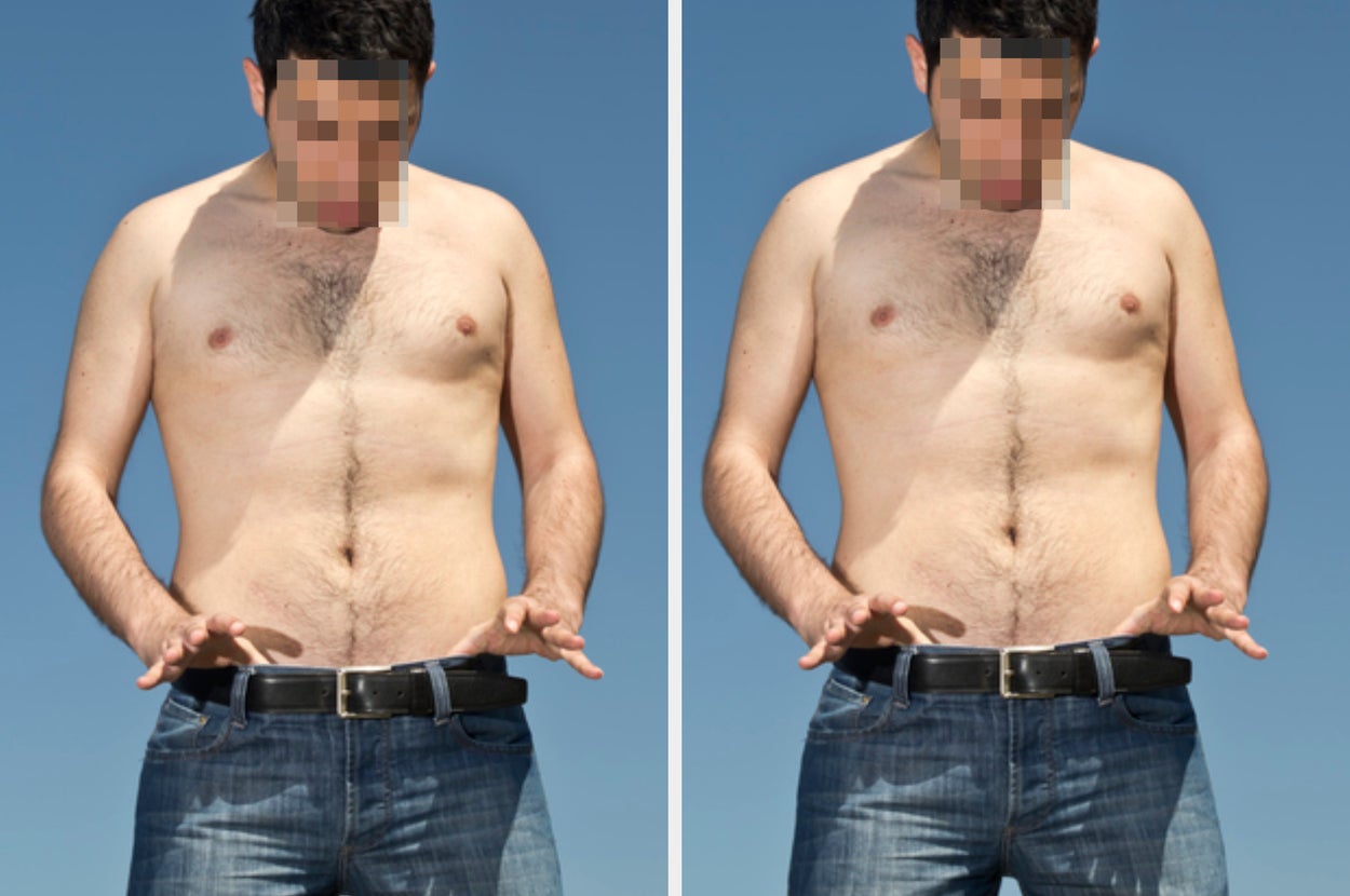 Men Who Have Gotten Vasectomies Are Sharing Their Stories And Some Of Them May Surprise You