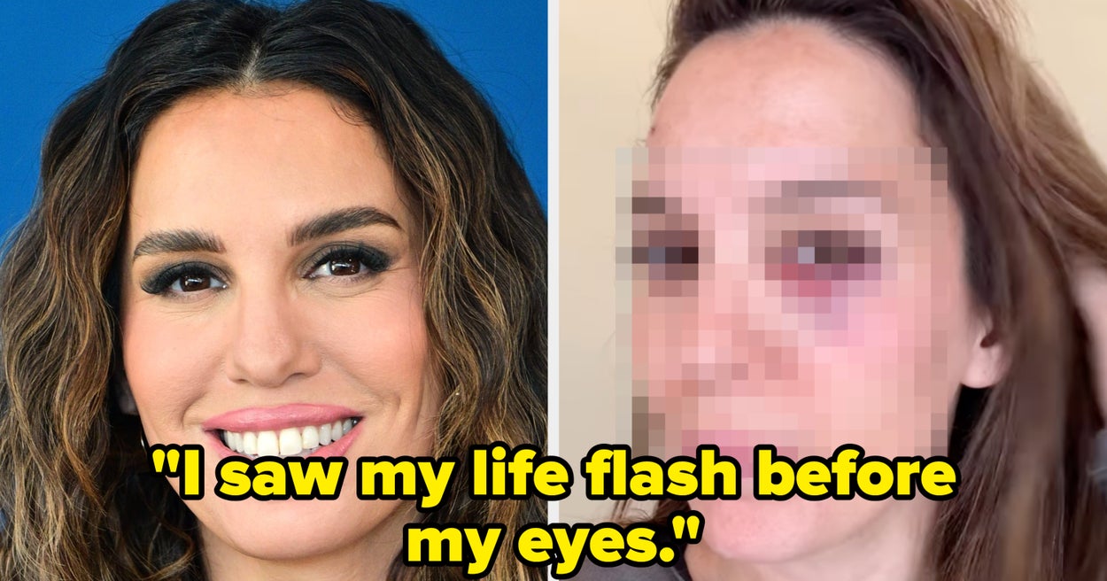 Christy Carlson Romano Was Shot In The Eye While Shooting Clay Pigeons And She Revealed What Happened  BuzzFeed Christy Carlson Romano Was Shot In The Eye While Shooting Clay Pigeons And She Revealed What Happened  BuzzFeed