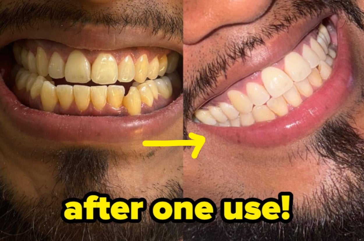 36 Products With Before-And-Afters That Will Give You FOMO