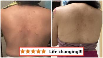 Reviewer showing results of utilizing Cerave cleanser