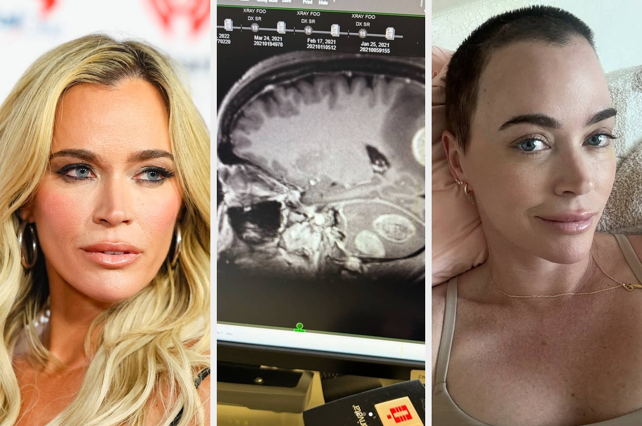 Reality Star Teddi Mellencamp Is Beautifully Opening Up About Her Multiple Brain Tumors And The Treatment She's Currently Undergoing