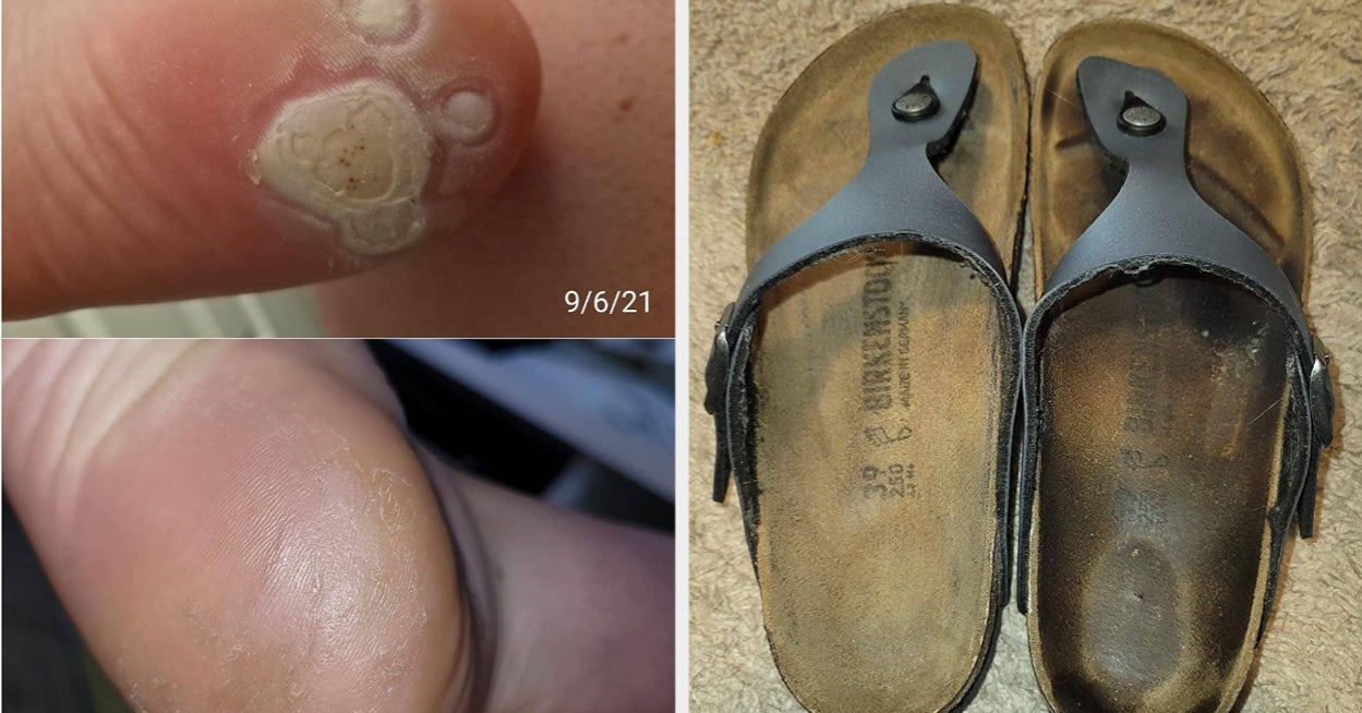 These 30 Products Have Impressive Results…Which Is Even More Impressive When You See How Things Started