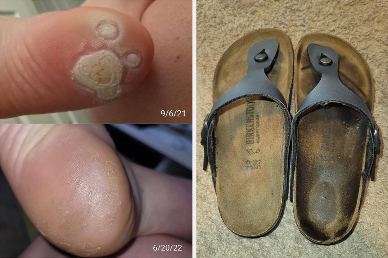 These 31 Products Have Impressive Results...Which Is Even More Impressive When You See How Things Started