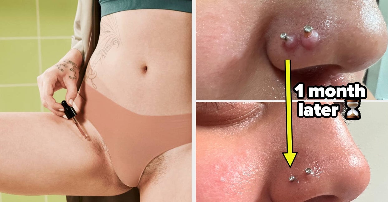 Here Are 30 Things To Deal With The Body Issues You’d Rather Not ...
