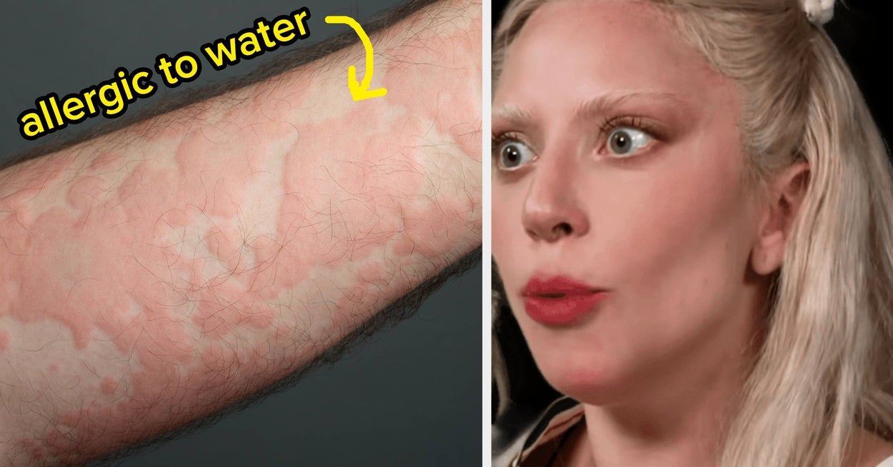 34 People Share The "Unusual" Body Things They Spent Most Of Their Lives Thinking Were Totally Normal