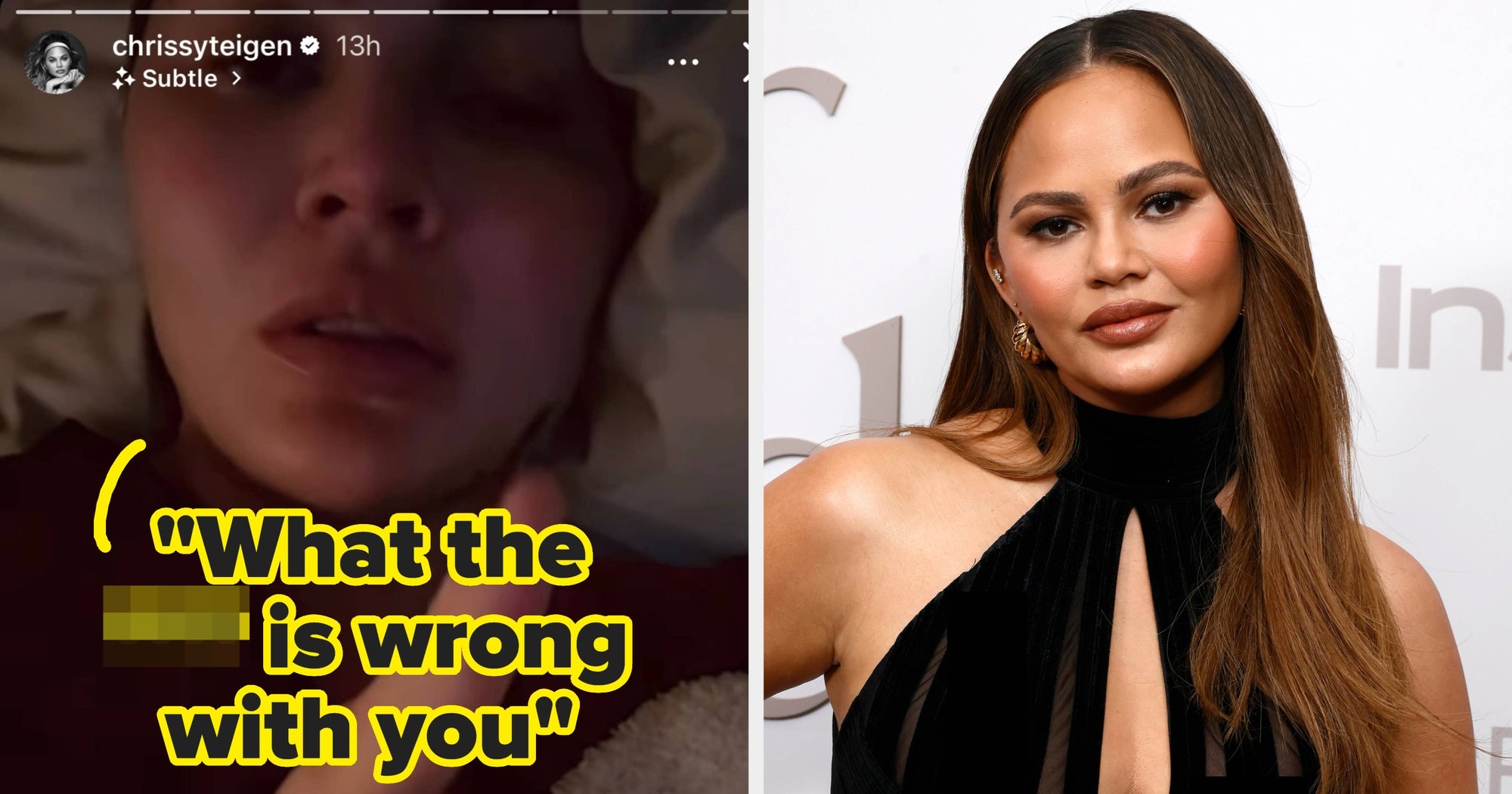 Chrissy Teigen Reacts To "Miserable" People Commenting On Her Appearance