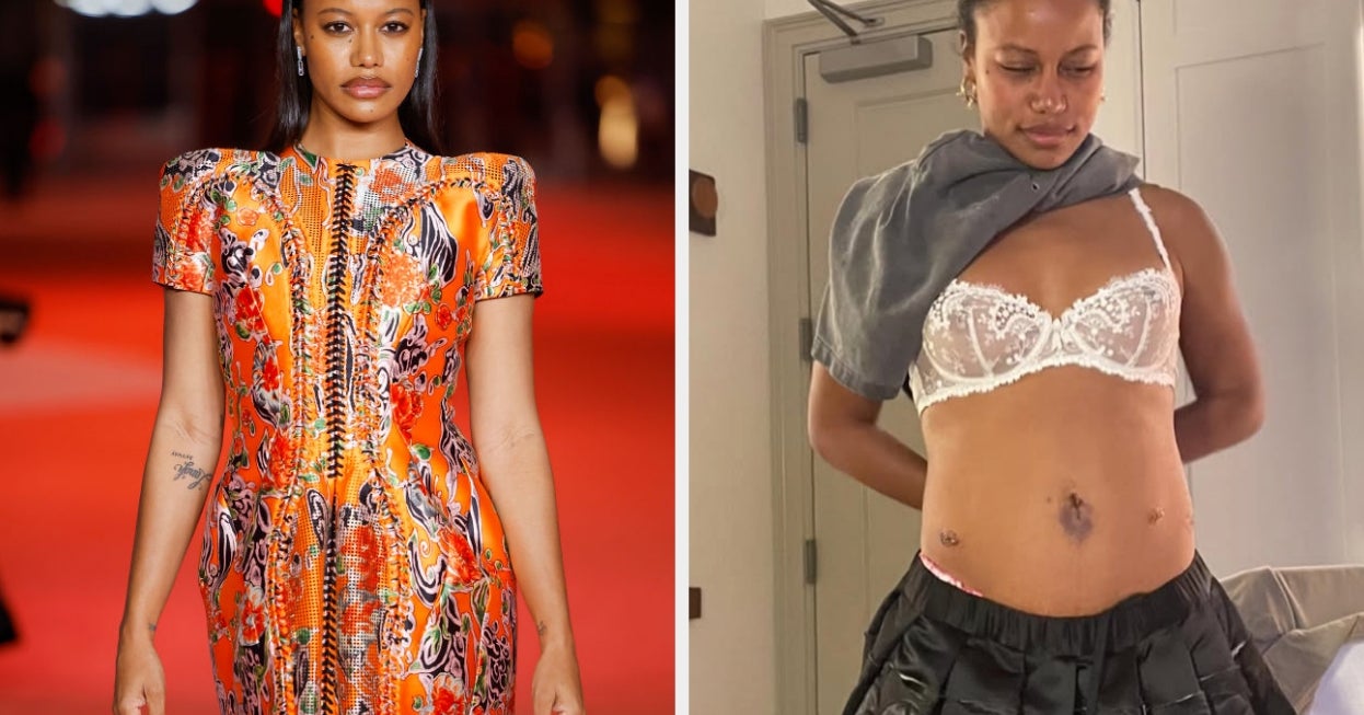 "Rasa sakit akan membuatku melihat bintang": Taylour Paige membuka tentang pertempuran diamnya dengan endometriosis