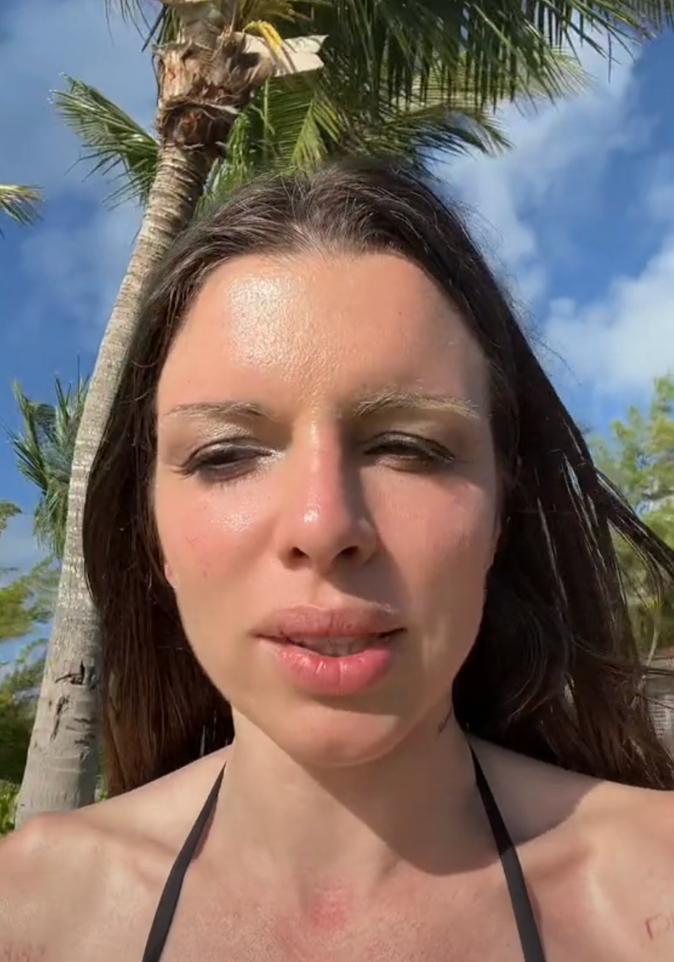 Person outdoors under palm trees, wearing a black halter top. Bright, sunny day