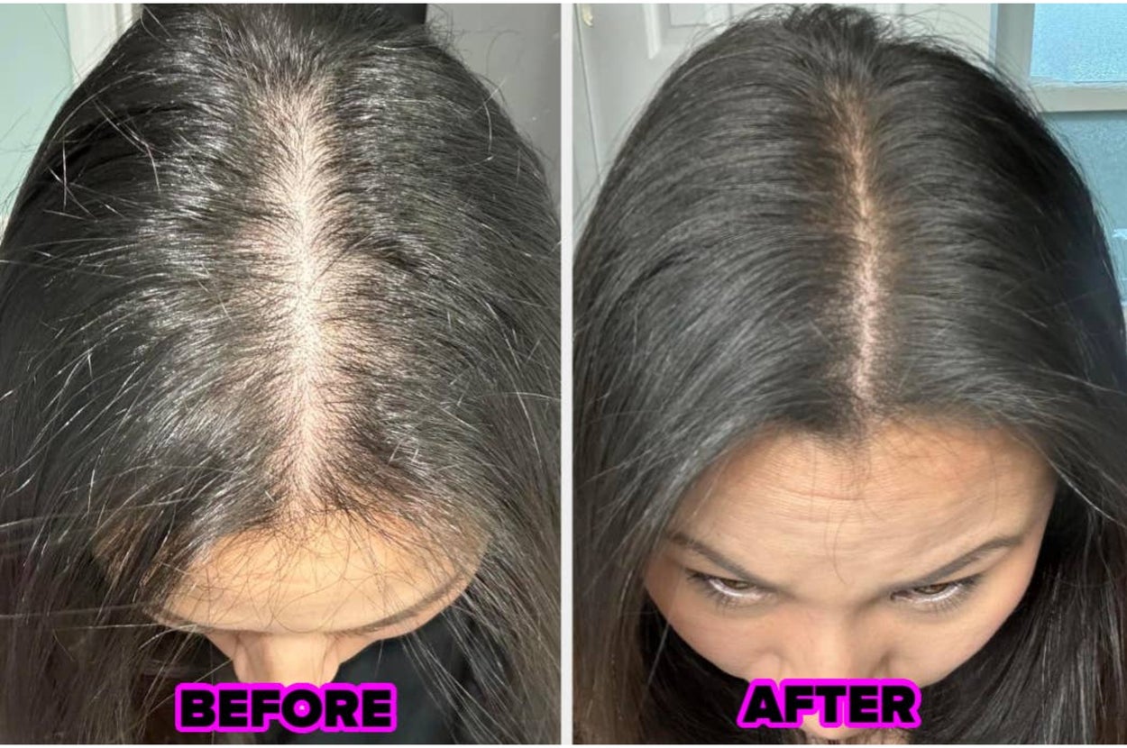 The Before And Afters For These 32 Products Are So Remarkable, They'd Get An A+ On Their Report Card