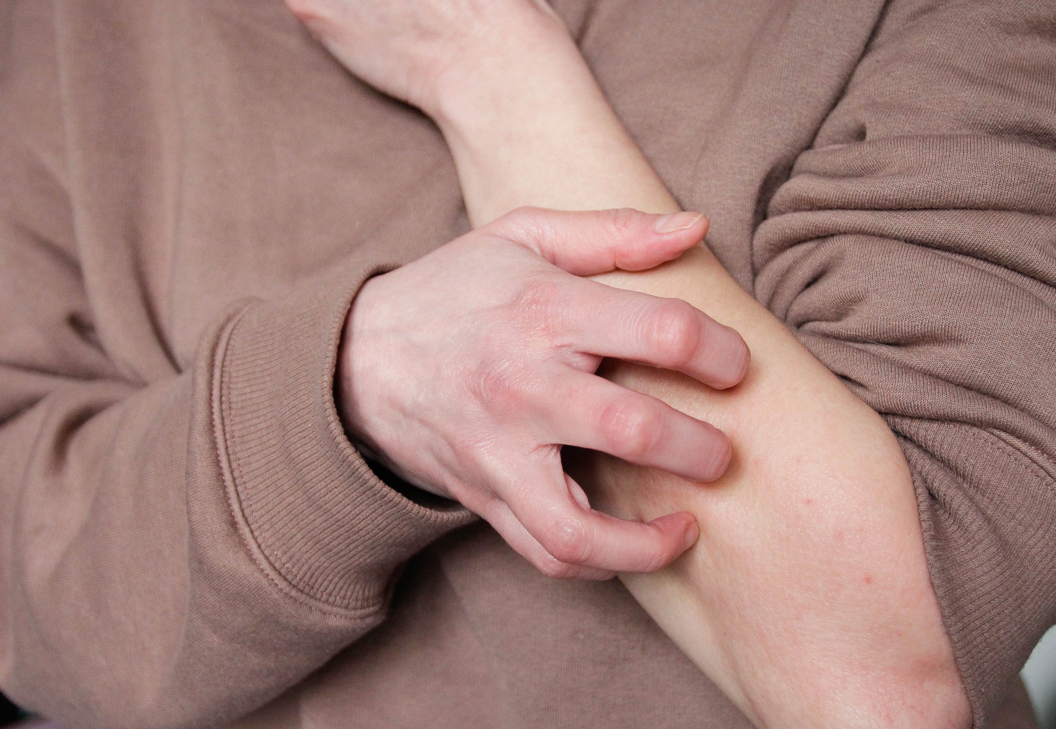 Person scratching their forearm with one hand, showing an action possibly related to discomfort or itchiness