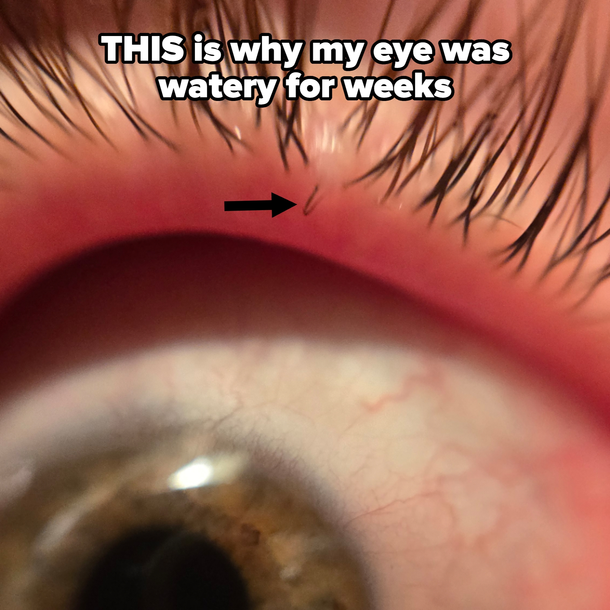 Close-up of a person's eye, focusing on the eyelashes and the detail of the iris