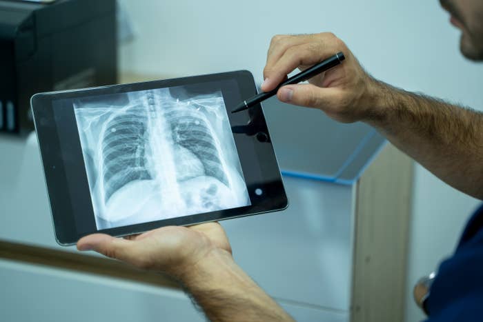 A person examines a chest X-ray displayed on a tablet, using a stylus to point out details