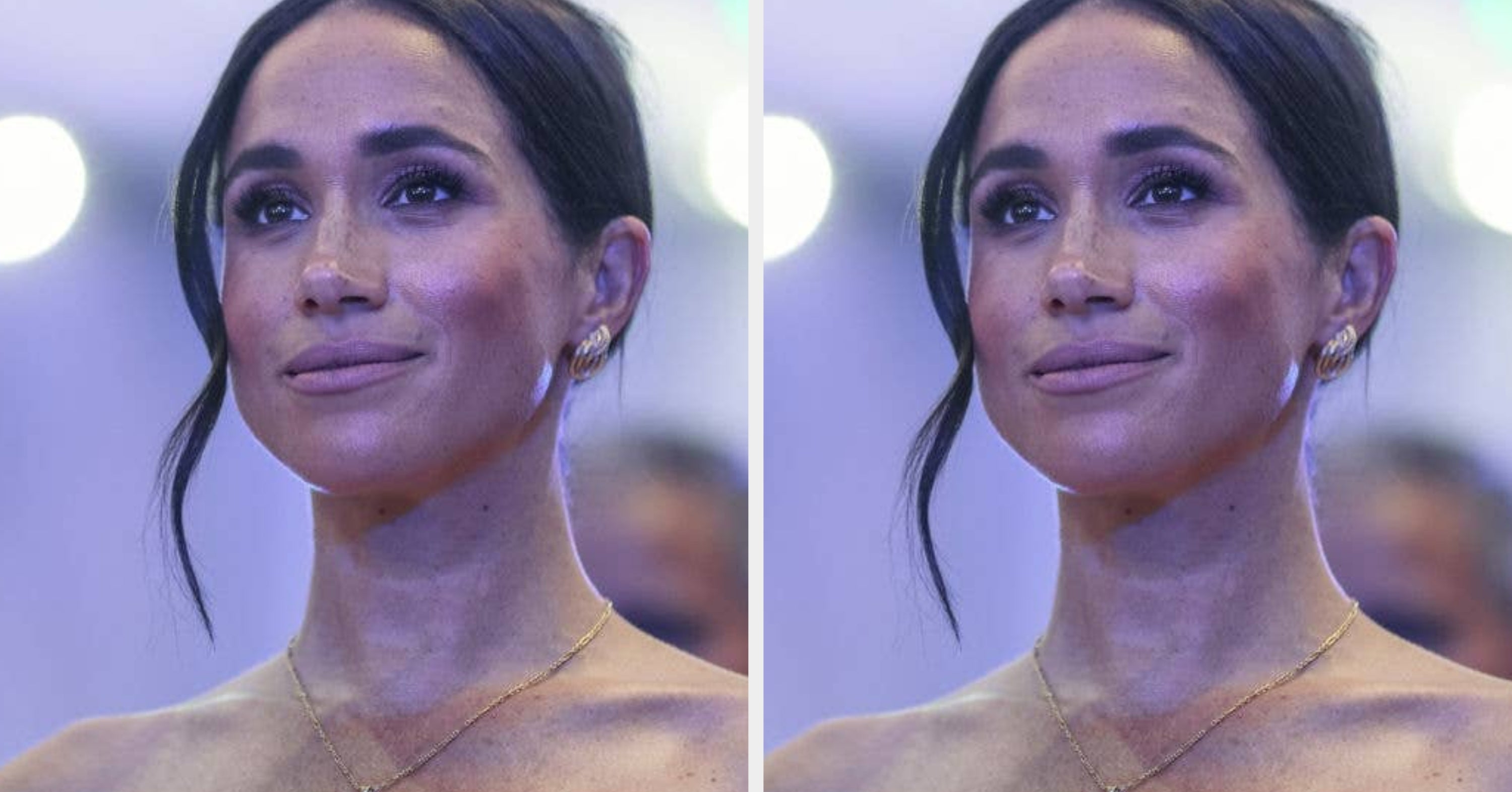 Meghan Markle Reveals Rare Postpartum Complication