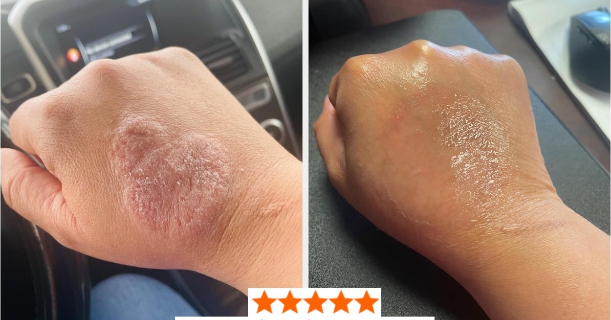 29 Problem-Solving Beauty Products For Those Issues You Didn’t Even Know Had Legit Solutions