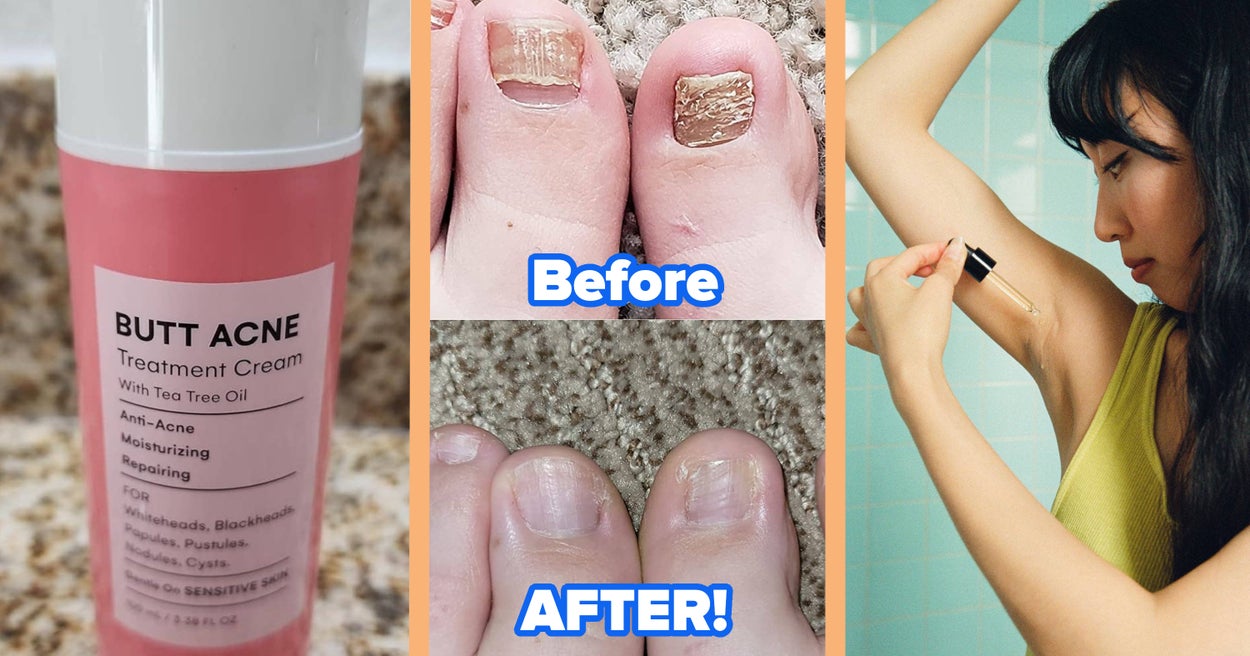 No Need To Feel Bad About Weird Body Stuff - We've All Been There And These 44 Things Can Help