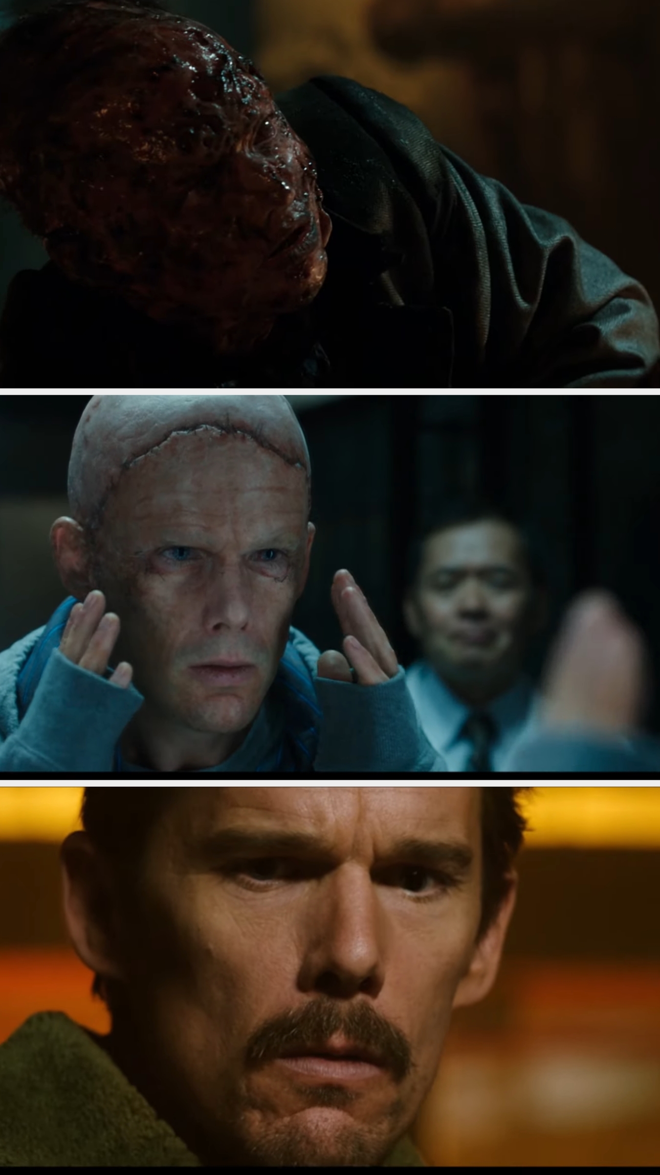 Three images from a movie scene: a person with a disfigured head, another with a shaved and scarred head, and a close-up of a man with a mustache looking serious