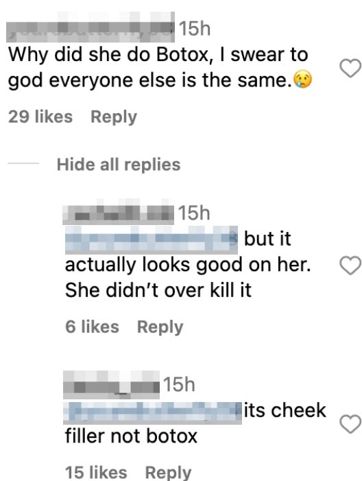 Comments discuss someone using Botox and cheek fillers