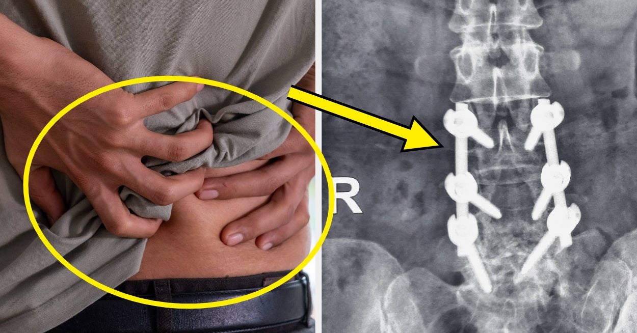 If You Have A Chronic Condition, I Want To Hear What You Thought Was "Normal" Until Your Diagnosis