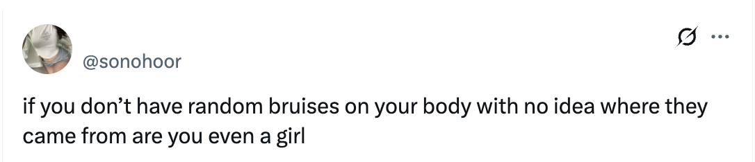 Tweet humorously questions if girls don't have random bruises without knowing their origin