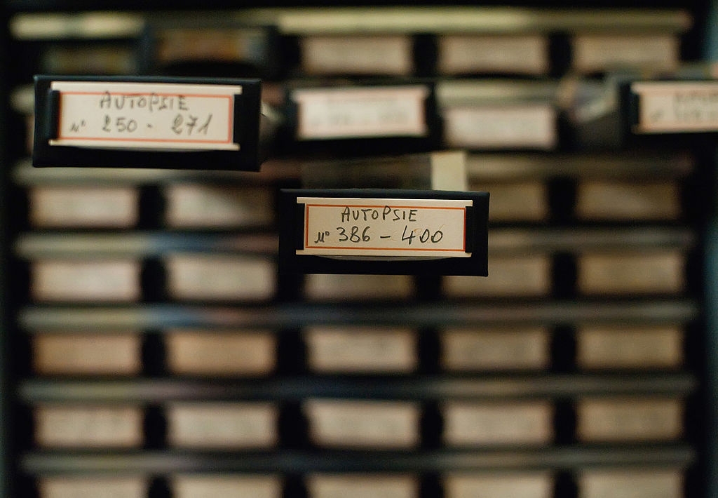 Drawers with handwritten labels, focusing on one marked "Autopsie No 386-400,"