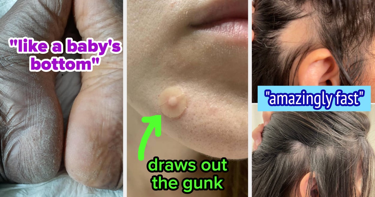 Dark Spots, Bumps, Fungus: 32 Solutions To Very Human Issues We All Grapple With