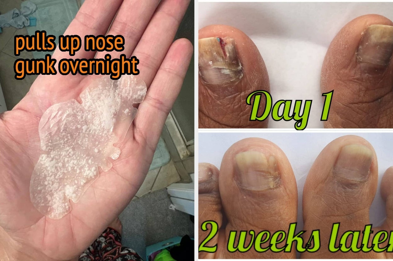 33 Products With Such Impressive Results That Oops, You Might Get A Little Bit Of A God Complex Using Them