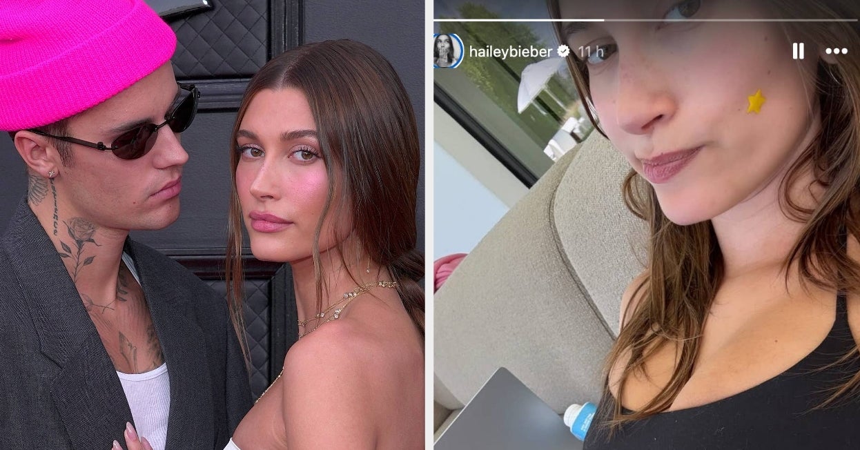 Hailey Bieber Showed What Her Body Looks Like With Two Ovarian Cysts As She Gave A Health Update