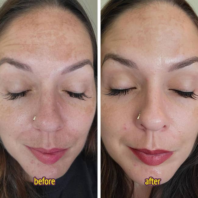 Close-up of a reviewer's look   showing a skincare transformation, with smoother complexion successful  the aft  representation  connected  the right