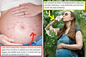 Pregnant person with rash on belly, highlighted by red arrow. Another person holding tissue sneezing near flowers, highlighted with yellow arrow