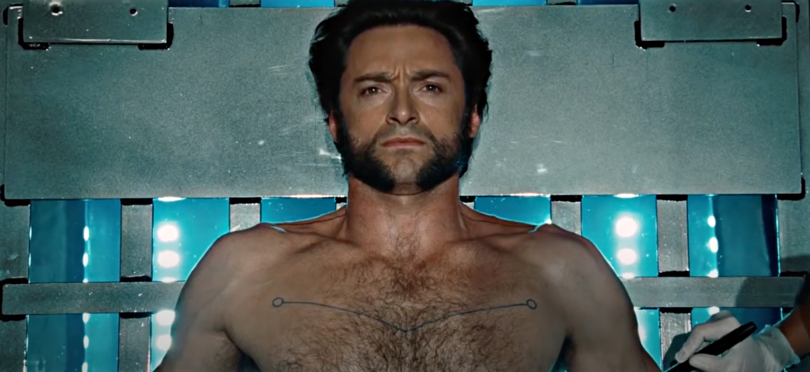 Wolverine lies shirtless on a metal table